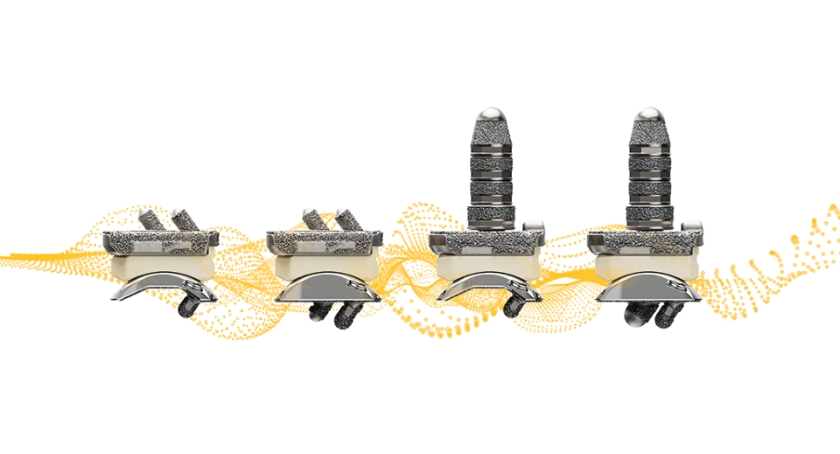 Stryker Rolls Out Incompass Total Ankle System